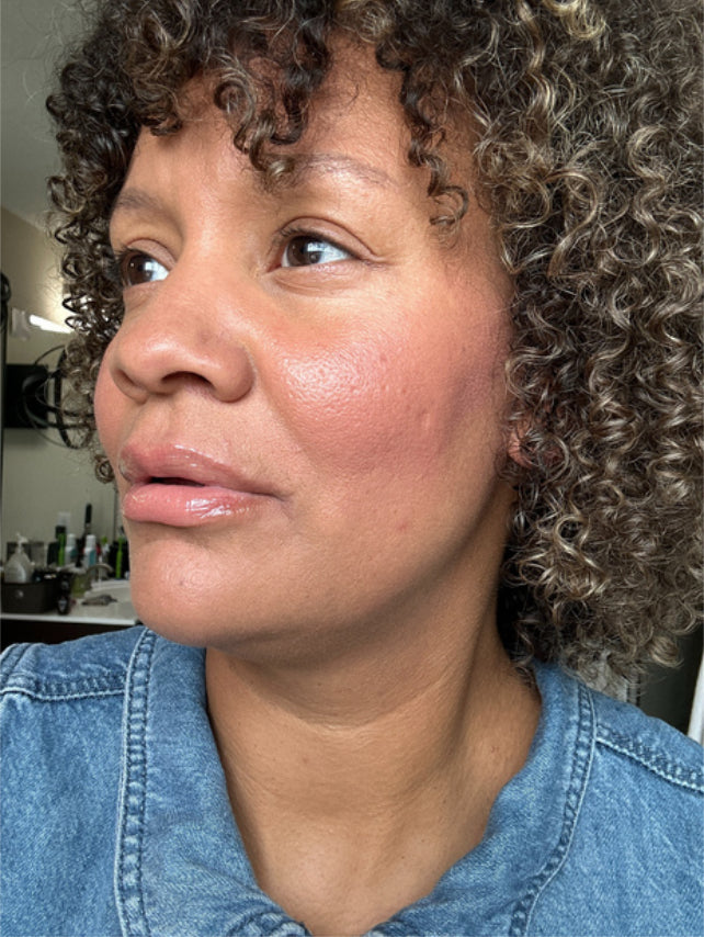 woman after using revive lip balm. Lips appear hydrated and plump.